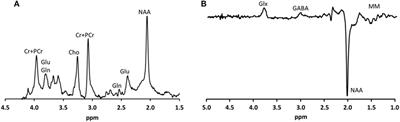 Intelligence and Brain Efficiency: Investigating the Association between Working Memory Performance, Glutamate, and GABA